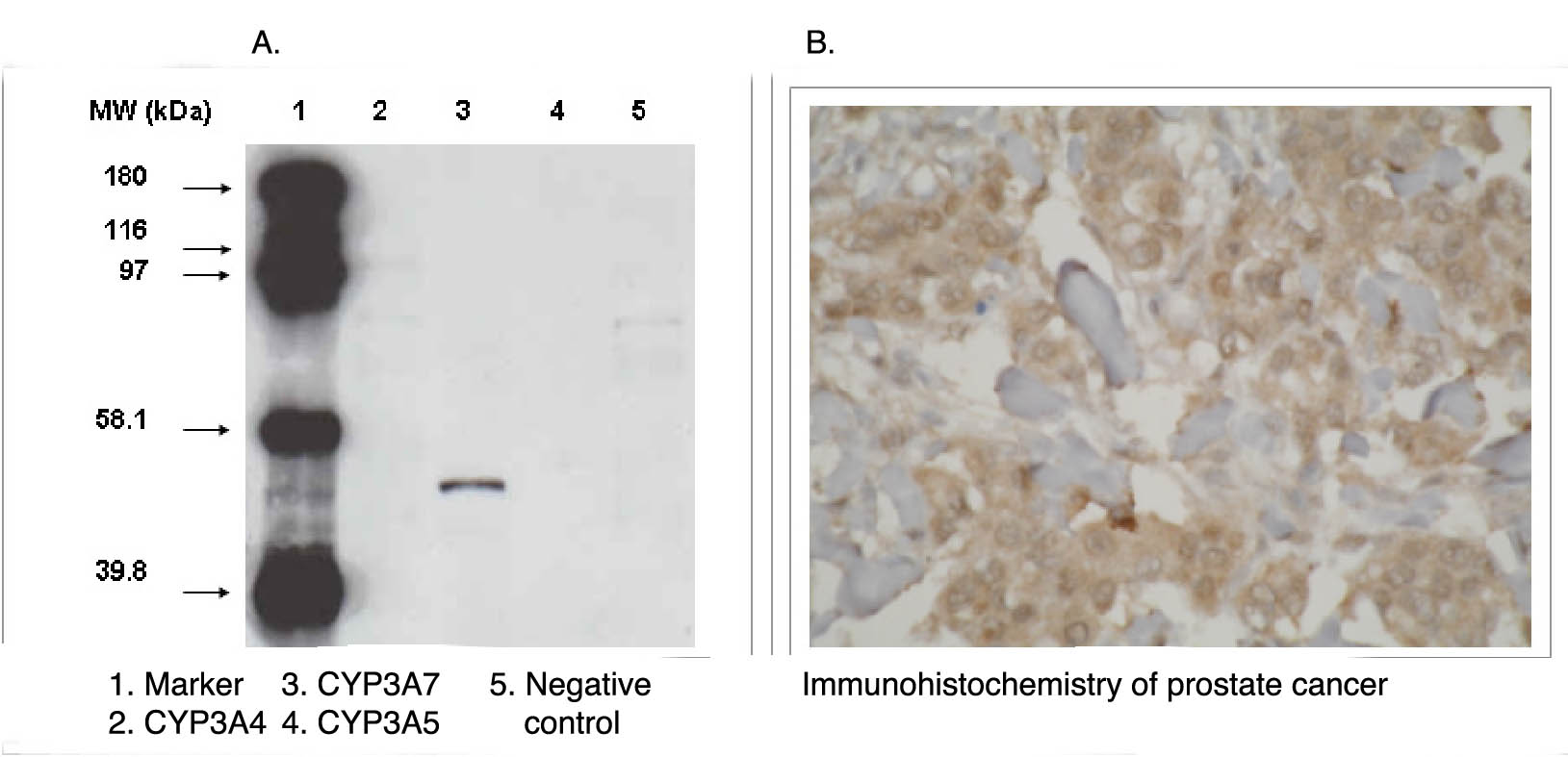"
A. Western blot analysis using CYP3A7 antibody (cat. no. X2048M) on various recombinant CYP450 proteins.
B. Immunohistochemistry staining of prostate cancer tissue using CYP3A7 antibody."